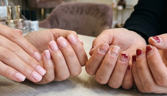 Tırnak Sağlığına Zarar Veren Alışkanlıklar ve Kaçınma Yolları